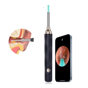 Nettoyeur de cérumen intelligent sans fil pour usage domestique, otoscope portable avec caméra Wi-Fi pour l'élimination visuelle du cérumen - Product Image 1