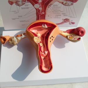 Modelo de Patología del Útero Humano para Ciencias Médicas, Modelo de Enfermedad Órgánica, Modelo Antidrogas - Product Image 5