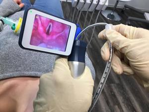 BESDATA lame de laryngoscope vidéo électrique pas cher prix outil d'intubation en acier réutilisable pour la gestion des voies respiratoires - Product Image 6