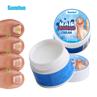 Crème de soin des ongles Sumifun 10g pour les pieds, vente en gros, LOGO personnalisé