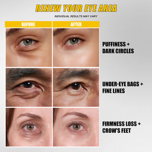 Crème pour les yeux à la caféine, soin de la peau, réduction des cernes, des rides, des poches, éclaircissement, hydratation, resserrement des yeux - Product Image 3