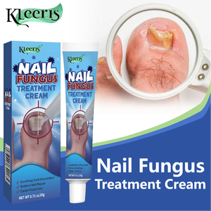 OEM Onychomykose-Behandlung Fußcreme Pilzentfernungscreme Anti-Infektions-Nagelpilz-Reparatur Chinesische Salbe - Product Image 1