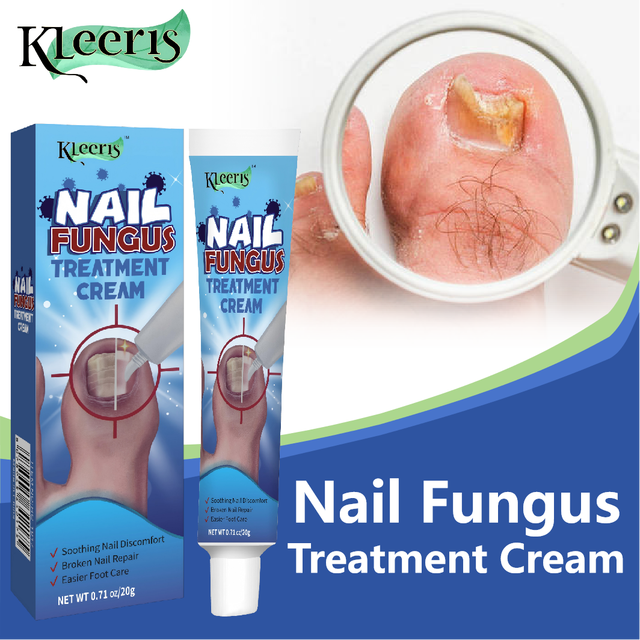 OEM Onychomycosis Treatment Foot Cream Fungus Removal Cream Anti Infection Nails Fungus Repair Chinese Ointment