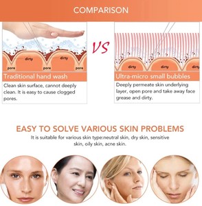6 en 1 H2O2 Hydra oxígeno cáscara de cuidado de la piel limpieza Facial Hydro dermoabrasión de oxígeno - Product Image 6