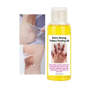 High Quality Yellow Peeling Oil Supplier Stretch Marks Peeling Oil Body Skin Peeling Oil