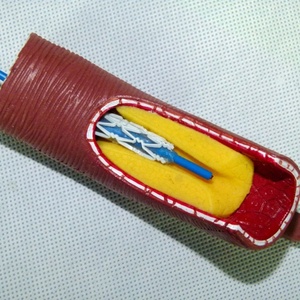 Modelo Anatómico de <span class=keywords><strong>Stent</strong></span> Vascular Humano SMM3192 (PVC) para Educación en Ciencias Médicas - Arteria Coronaria - Product Image 3