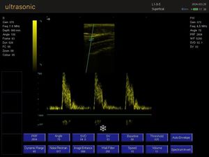 جهاز الموجات فوق الصوتية المحمول الرقمي بالكامل مقاس 15 بوصة بسعر المصنع المباشر للعيادات والمستشفيات - Product Image 3