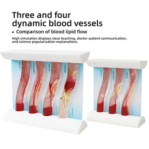 แบบจำลองหลอดเลือดแบบไดนามิก การเปรียบเทียบการอุดตันของคราบไขมันในหลอดเลือดแดงสำหรับการ<span class=keywords><strong>สอน</strong></span>ทางการแพทย์ - Product Image 5
