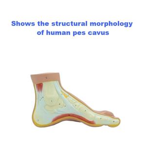 Modelo Anatómico de Sección del Arco del Pie <span class=keywords><strong>Humano</strong></span>, PVC, Estructura de Músculos, Ligamentos <span class=keywords><strong>y</strong></span> <span class=keywords><strong>Huesos</strong></span> del Pie, Modelo de Enseñanza Médica - Product Image 2