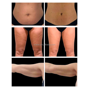 Máquina Facial <span class=keywords><strong>2</strong></span> en 1 de Calor y Frío para Reducir Grasa Corporal, Lifting Facial y Reafirmación de la Piel - Product Image 6
