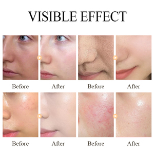 5 loại cây kết hợp mặt nạ Hộp gói Aloe Vera Sakura trà xanh cà rốt xương rồng 30g * 5 cái/hộp mặt nạ - Product Image 6