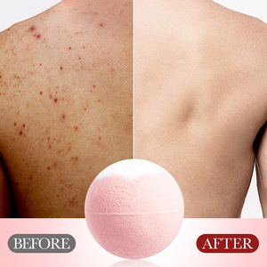 SADOER Limpieza profunda Suavizante Hidratante Blanqueamiento Sabor Baño SPA Fizzy Bubble Rose Aceite esencial Baño Sal <span class=keywords><strong>Boom</strong></span> Balls - Product Image 6