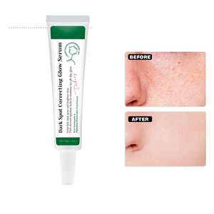 سيروم تفتيح الوجه المرطب والمصحح للبقع الداكنة لإشراقة البشرة مناسب لجميع أنواع البشرة - Product Image 1