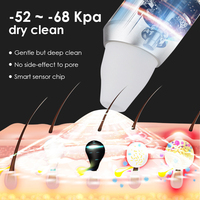 Appareil de beauté Synogal pour le visage, aspirateur de points noirs, stylo anti-acné et anti-points noirs avec caméra
