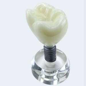 Modelo Dental Transparente para Comunicación Manual entre Médico y Paciente, Implante de Cristal, Accesorios para Terapia Oral, Certificado CE - Product Image 5