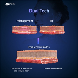Nhà sử dụng thiết bị làm đẹp chuyên nghiệp mặt nâng lên <span class=keywords><strong>RF</strong></span> để nâng mặt - Product Image 5