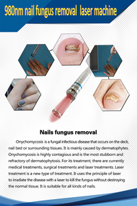 Máquina portátil de eliminación de venas varicosas con láser de diodo de 980nm para uso en salones de belleza - Product Image 4