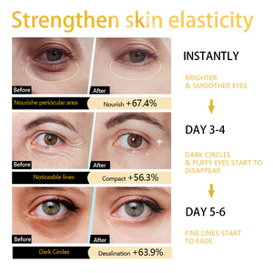 10 Pares de <span class=keywords><strong>Parches</strong></span> de Caviar Multiefecto <span class=keywords><strong>para</strong></span> el Contorno de <span class=keywords><strong>Ojos</strong></span>, <span class=keywords><strong>para</strong></span> Aliviar la Hinchazón y las <span class=keywords><strong>Bolsas</strong></span> de <span class=keywords><strong>los</strong></span> <span class=keywords><strong>Ojos</strong></span>, con Beneficios Antienvejecimiento - Product Image 6