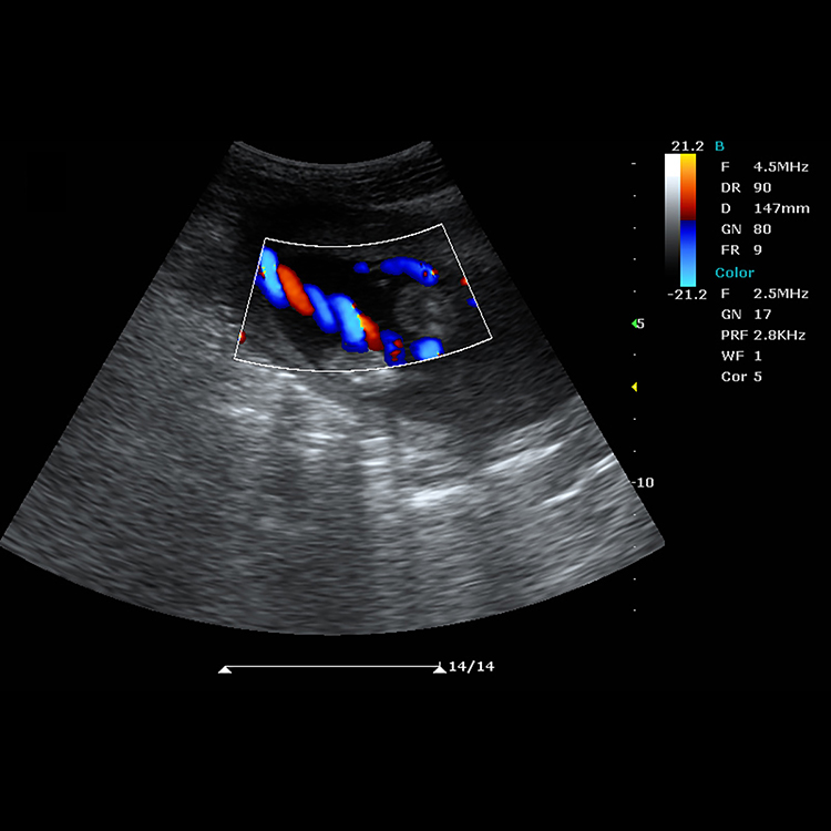 Máquina de ultrasonido Doppler en color para diagnóstico médico con diseño nuevo de 2022