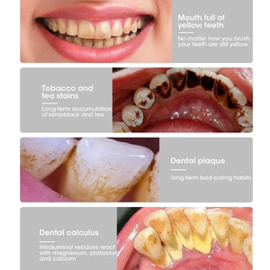 Cepillo de dientes eléctrico con limpieza sónica 3 en 1 para eliminar el sarro, blanquear los dientes, cuidado bucal, carga USB, reemplazo del cabezal del cepillo - Product Image 3