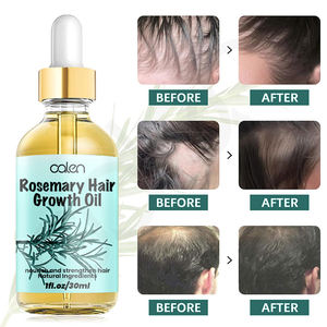 Bán buôn OEM kích thích tăng trưởng tóc giảm rụng tóc hữu cơ tăng trưởng tóc dầu hương thảo - Product Image 6