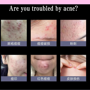 フェイトリートメント用カラフルスターハイドロコロイドにきびパッチサリチル酸とティーツリーオイルにきびパッチ - Product Image 2