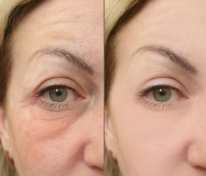 G PDRN ácido hialurónico colágeno suero para ojos elasticidad de la piel reduce las líneas finas ojeras arrugas Crema para los ojos cuidado de la piel coreana - Product Image 6