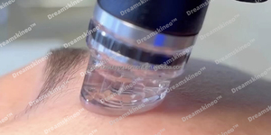 Nouvelle Machine Faciale Hydro Booster 2025 – Ampoules, Embouts, Ballons et Solution Sérum du Fournisseur Original Hydrofacy - Product Image 4