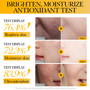 Masque Visage et Corps à l'Acide Hyaluronique SADOER, Meilleur du Fabricant Direct, Réparateur Profond, Hydratant et Éclaircissant, OEM ODM - Product Image 6