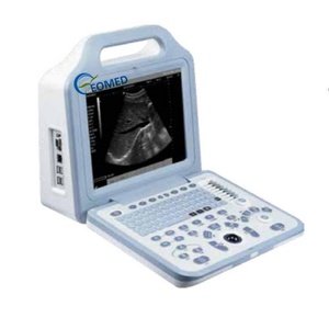 Échographe portable le moins cher, imagerie numérique complète, appareil à ultrasons pour la grossesse et la médecine vétérinaire BW21B - Product Image 1