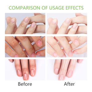 Productos para el Cuidado <span class=keywords><strong>de</strong></span> las Uñas a Precio <span class=keywords><strong>de</strong></span> Mayoreo, <span class=keywords><strong>Aceite</strong></span> para Cutículas <span class=keywords><strong>de</strong></span> Uñas <span class=keywords><strong>de</strong></span> Cuidado Natural, <span class=keywords><strong>Aceite</strong></span> para Cutículas <span class=keywords><strong>de</strong></span> Uñas <span class=keywords><strong>de</strong></span> Cuidado Profesional - Product Image 6