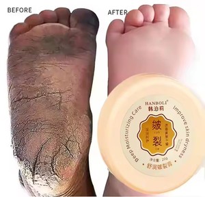 Cura della pelle bellezza Anti tacchi secchi incrinati crema per la cura dei piedi crema idratante intensiva sbiancante riparazione del piede e della mano - Product Image 1