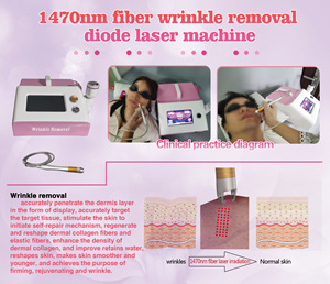 เครื่องเลเซอร์ไดโอด 1470 นาโนเมตร สำหรับฟื้นฟูผิวหน้า พร้อมหัวประคบเย็นแบบค้อน  ลำแสงเล็งเป้าหมาย 650 นาโนเมตร สายไฟเบอร์ยาว 2 เมตร สำหรับการต่อต้านริ้วรอยแบบไม่รุกล้ำ - Product Image 3