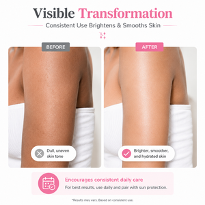 <span class=keywords><strong>Crème</strong></span> hydratante pour la <span class=keywords><strong>peau</strong></span>, les mains, les jambes, éclaircissant, blanchissant, correcteur de points noirs, lotion pour le corps avec AHA Niacinamide - Product Image 4
