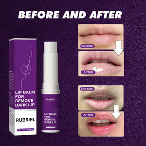 Bálsamo Labial al por Mayor de Fábrica para Eliminar Labios Oscuros, Bálsamo Nutritivo Profundo para el Cuidado de los Labios, para Marca Privada - Product Image 4