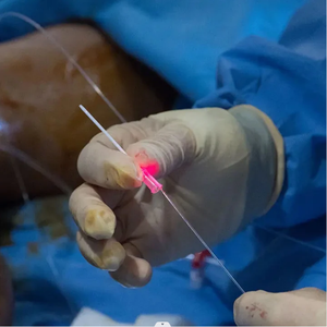 Evlt EVLA Diodo de Ablación Endovascular Láser 1470nm Dispositivo de Diodo para Venas Varicosas <span class=keywords><strong>Piernas</strong></span> Venas Prominentes Dolor de <span class=keywords><strong>Piernas</strong></span> - Product Image 1