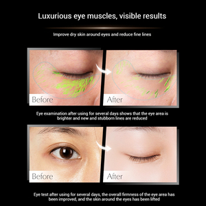 <span class=keywords><strong>Crema</strong></span> Contorno <span class=keywords><strong>Occhi</strong></span> Private Label per la Rimozione delle Borse, <span class=keywords><strong>Crema</strong></span> al Retinolo Antirughe e Anti-Età per la Cura degli <span class=keywords><strong>Occhi</strong></span> - Product Image 6