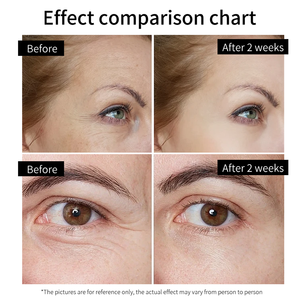 Krim pelembap anti-penuaan para wajah dengan 5% <span class=keywords><strong>ASAM</strong></span> hialuronat, Retinol, dan kolagen, Krim pemutih dan perawatan kulit. - Product Image 5