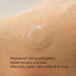 <span class=keywords><strong>2026</strong></span> सबसे ज्यादा बिकने वाले किनारे-दबाया मुँहासे पैच अल्ट्रा-पतले किनारे अदृश्य पिम्पल कवर - Product Image 4
