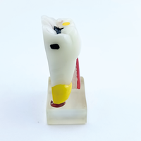 Modelo Anatómico de Molar Patológico Dental de 4 Veces el Tamaño Real, Simulación de Perfil de Caries, Modelo de Enseñanza para Entrenamiento Dental