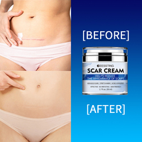 Crema Corporal Vegana Herbal de Venta Caliente para Adultos, Reafirmante de Piel, Tratamiento para Queloides y Cicatrices, Nutritiva, Blanqueadora de Estrías