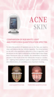 Analizador de Piel Profesional con Tecnología Avanzada de Imagen Facial para un Diagnóstico Preciso de la Piel, Aplicaciones de Spa 2026