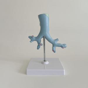 Modelo de Enseñanza Médica, Modelo de Anatomía Patológica de las Bronquias para la Educación en Medicina Respiratoria y Pulmonología - Product Image 2