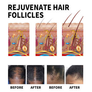 OEM organique renforcement réparation poils incarnés sérum extrait croissance des <span class=keywords><strong>cheveux</strong></span> huile bouteilles pour femmes noires ordinaire - Product Image 5