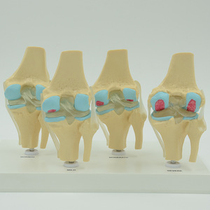 Le fabricant transforme et vend en gros des modèles de genou articulé à quatre étapes de développement ; manuel de chirurgie médicale du genou, des mains et des pieds. - Product Image 1