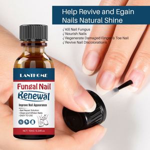 <span class=keywords><strong>Meilleur</strong></span> <span class=keywords><strong>traitement</strong></span> contre les infections fongiques, remèdes Lanthome pour la réparation des ongles fongiques - Product Image 4