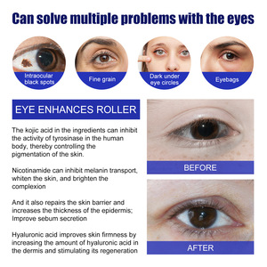 Gran oferta, reduce los círculos negros y la hinchazón debajo de los ojos, Mejora la firmeza de la piel, rodillo de masaje de ojos - Product Image 4