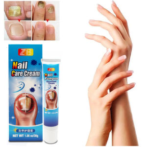 ZB 30g Nagel Onycho mykose Pilz behandlung Fuß creme Pilz entfernungs creme Paronychie Anti-Infektion Nagel pilz Reparatur Salbe - Product Image 2