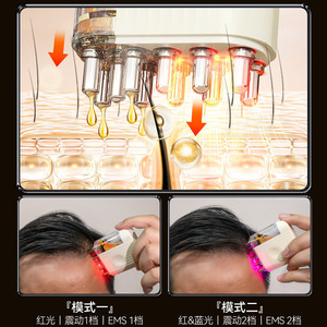 Aplicador Eléctrico de Medicamentos para el Cuero Cabelludo con Masaje por Vibración y Luz Roja de 70 mm x 55,3 mm para el Cuidado de la Cabeza y el Crecimiento del Cabello - Product Image 2