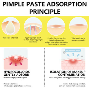 <strong>5</strong>-in-1 Acne Cover Patch Sticker Private Label Day and Night with Multiple Fade Acne Mark <strong>Hydrocolloid</strong> Acne Pimple Patches - Product Image 5